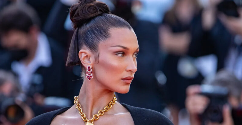 Bella Hadid Dedah Sejarah Pembedahan Plastiknya