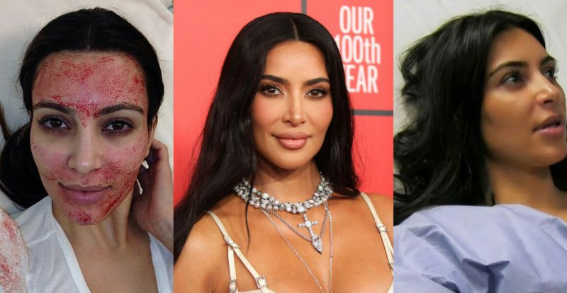 5 Selebriti Hollywood Ini Amalkan Tip Kecantikan Yang Pelik